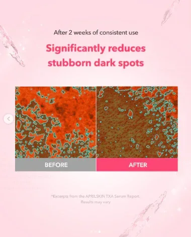 Aprilskin - TXA Purity 99% Ampoule - Image 3