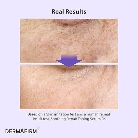 Dermafirm -  Soothing Repair Toning Serum R4 - 30ml - Image 4