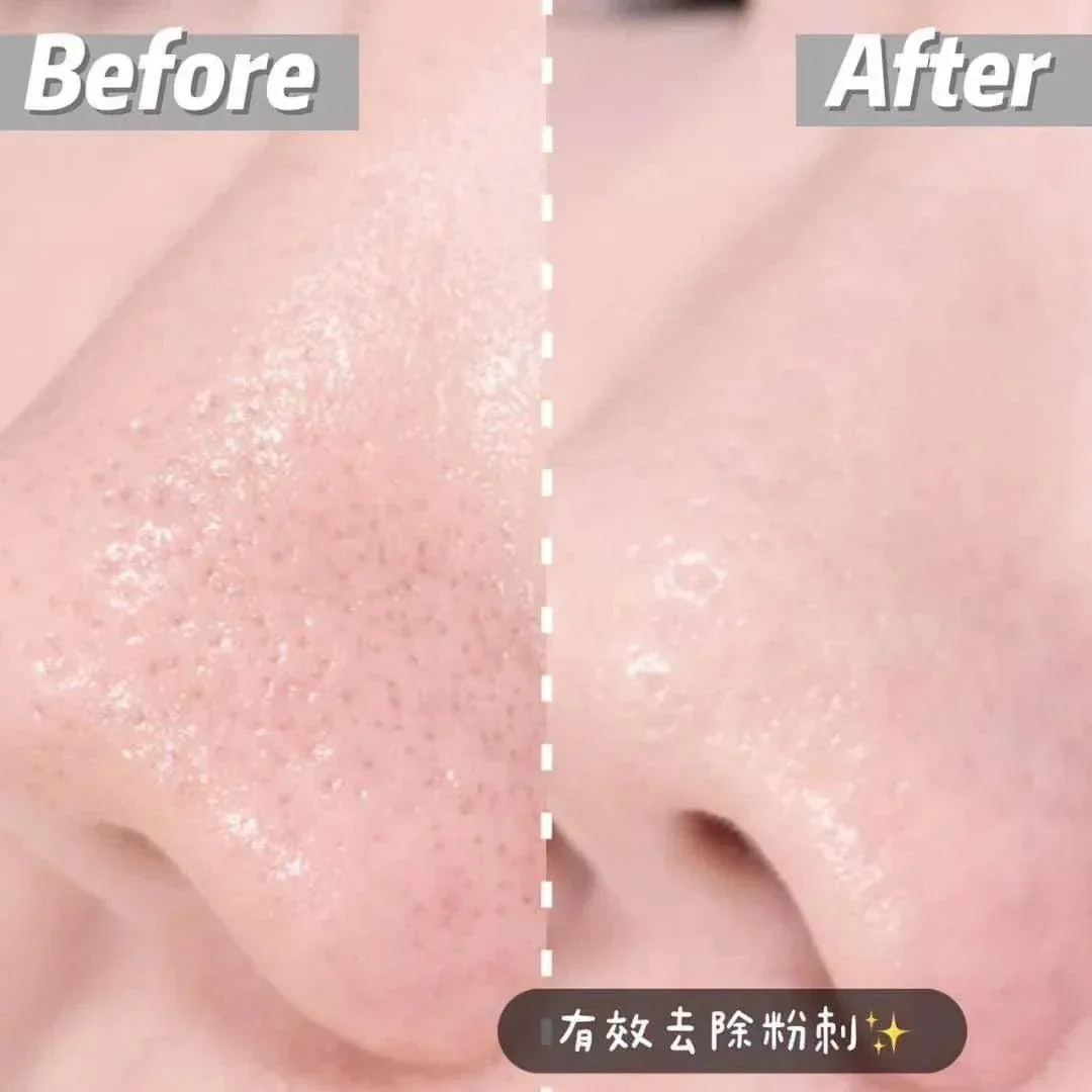 Dong A - Aclean 20g - Image 3