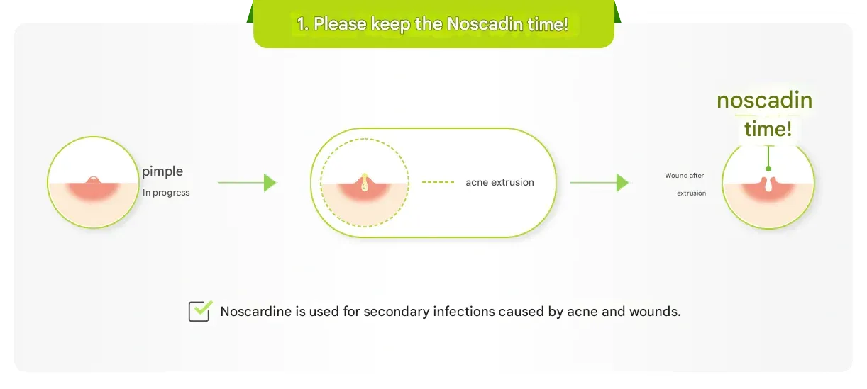 Dong A - Noscardin (NEW) 18g (For Post Acne Healing) - Image 2