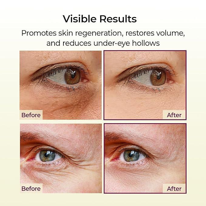 Dr Melaxin - Cementere Calcium Volume Multibalm 9g - Image 3