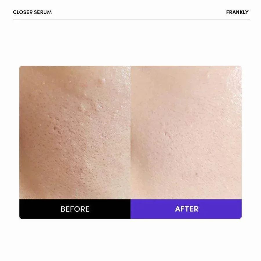 Frankly - Closer Pore Reducing Serum 60ml - Image 4