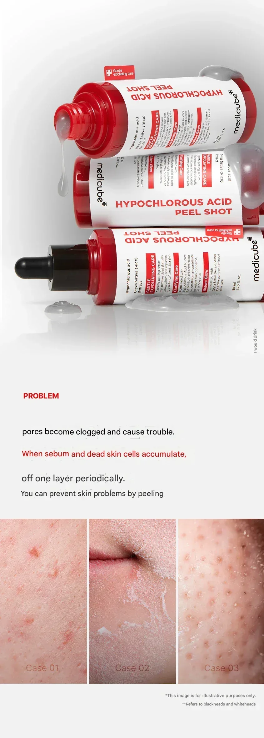 Medicube - Hypochlorous Acid Peel Shot 80ml - Image 4