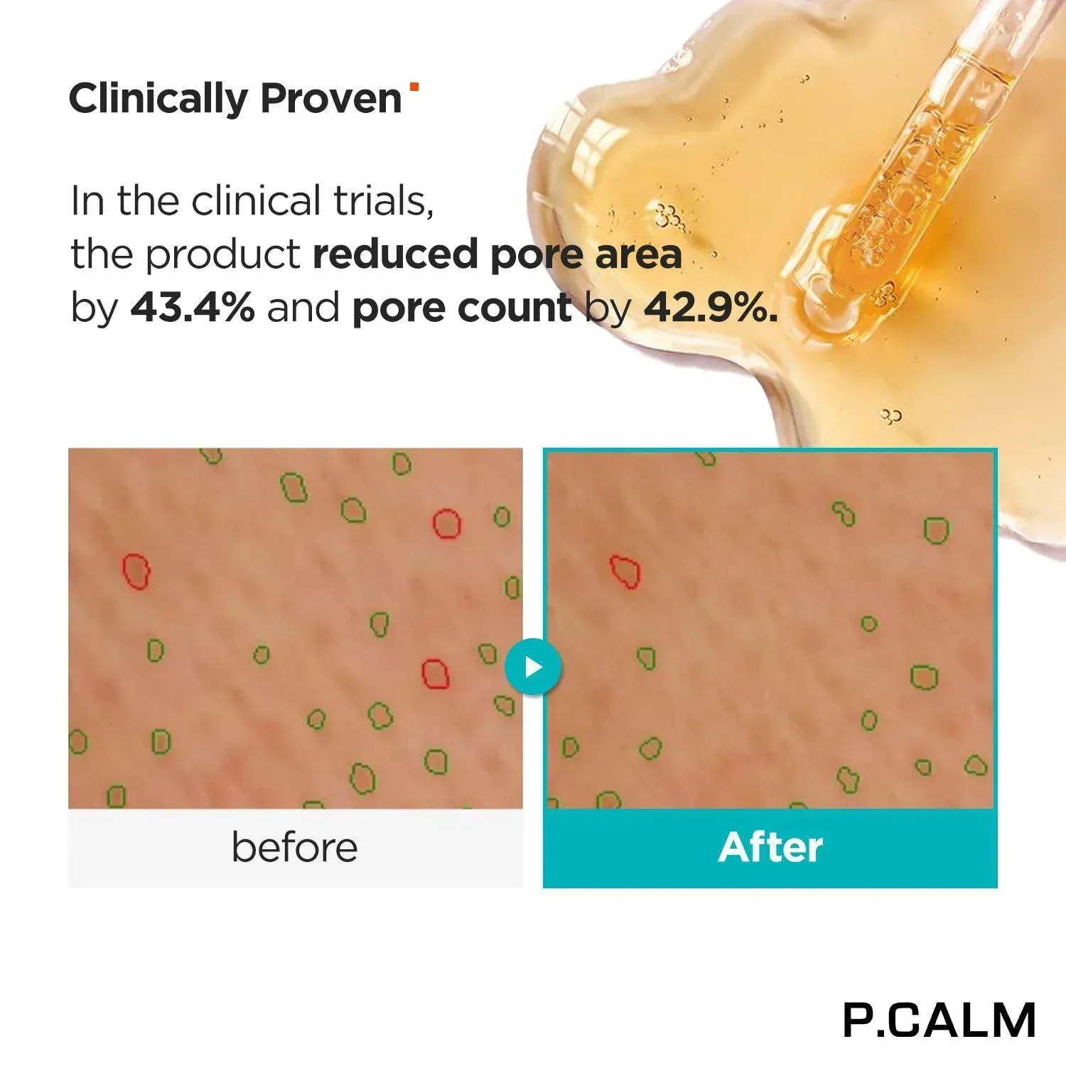 P Calm Retinolagen Ampoule 30 ml - Image 3