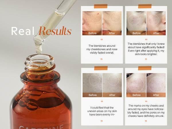 Shaishaishai - Caffeine Shot Vita C Toning Serum 50ml - Image 4