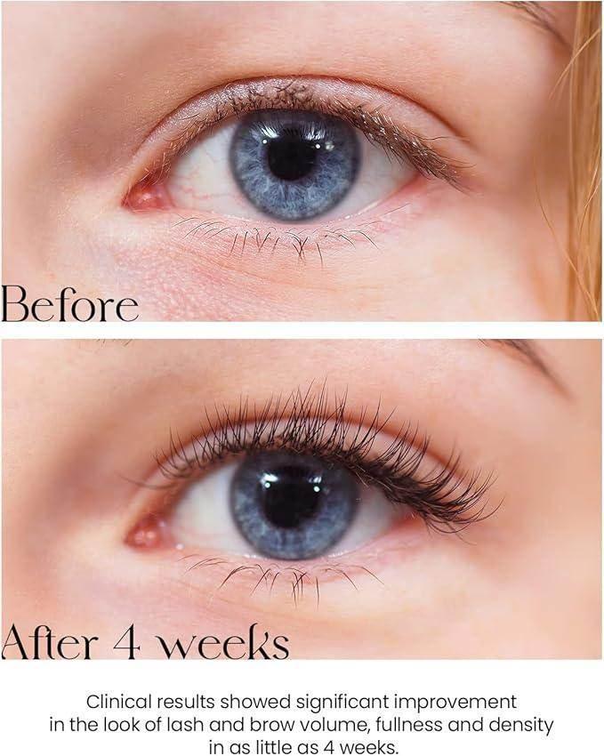Son&Park Real Eyelash Serum Clear 15g - Image 4