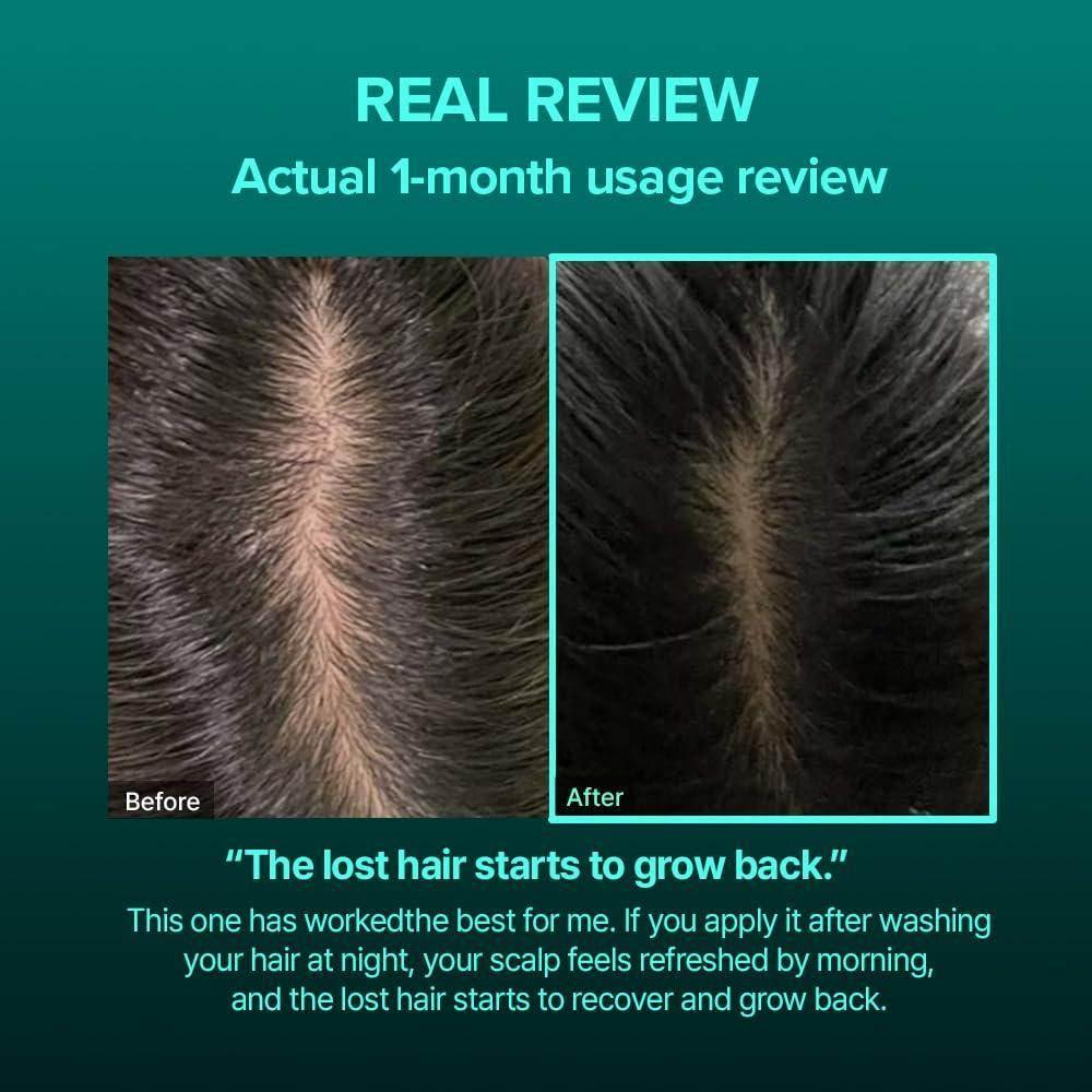 Vivelab - Anti Hair Loss Scalp Protein Treatment 200ml - Image 2